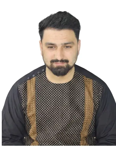 After hair transplant